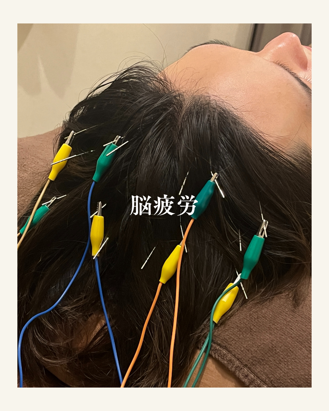 肋間神経痛の主な症状 (7)